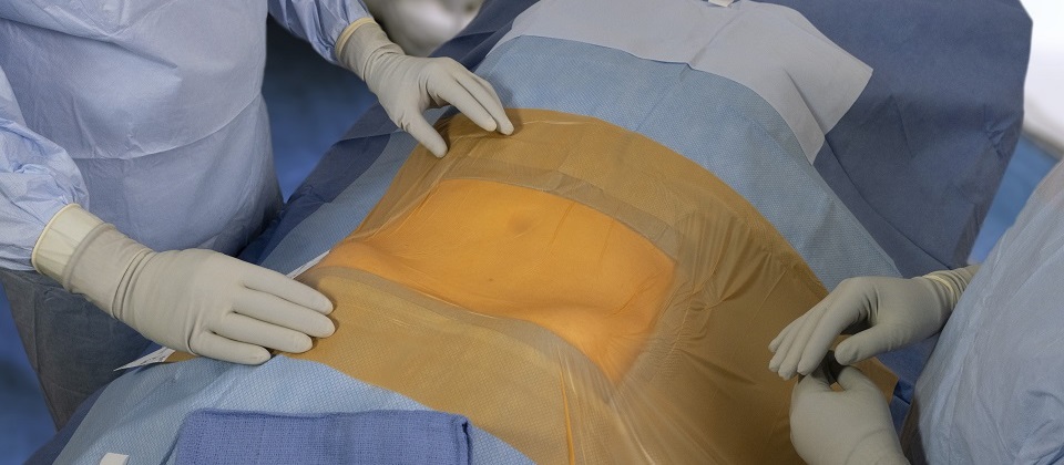 New Cardinal Health surgical drape helps reduce surgical site contamination risk